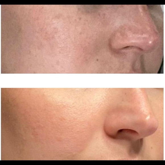 ATOMY GOLD COLLAGEN AMPOULE CUSHION - Picture 1 of 2